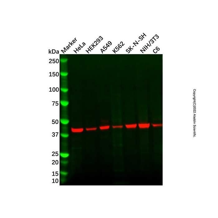 KMT1A/SUV39H1 Antibody