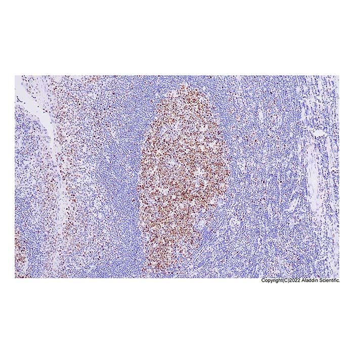 Recombinant KMT6/EZH2 Antibody