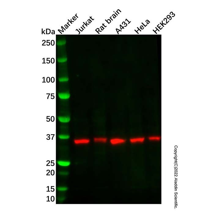 Recombinant Lactate Dehydrogenase A/B/C Antibody