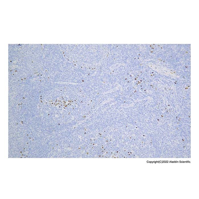 Recombinant Lambda Light chain Antibody