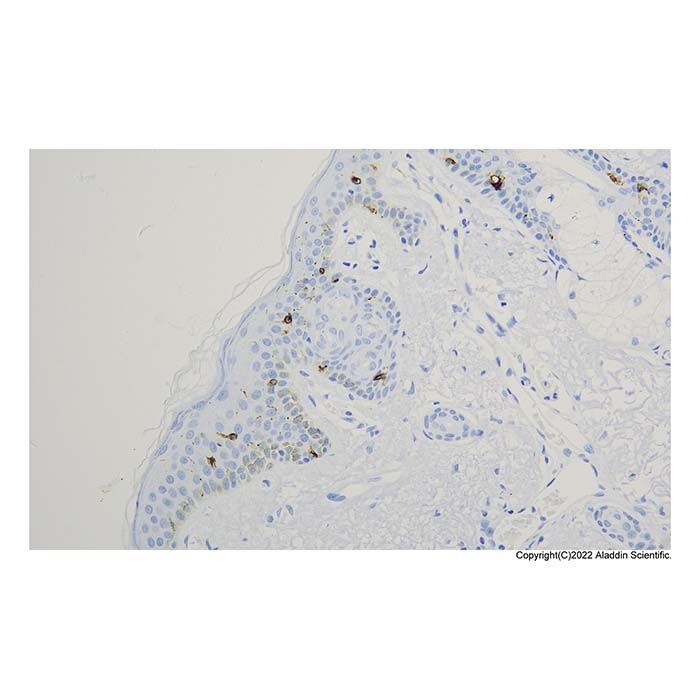 Recombinant Langerin Antibody