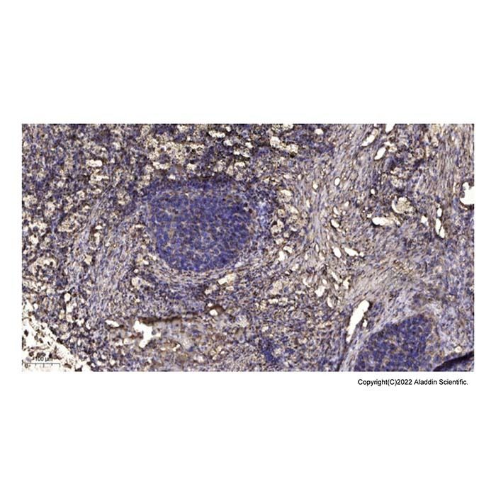 LASP1 Antibody