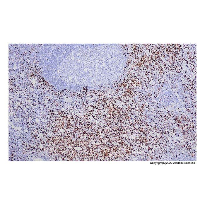 Recombinant LEF1 Antibody