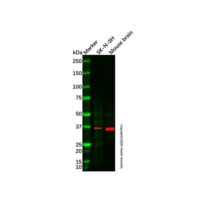 LEFTY2 Antibody