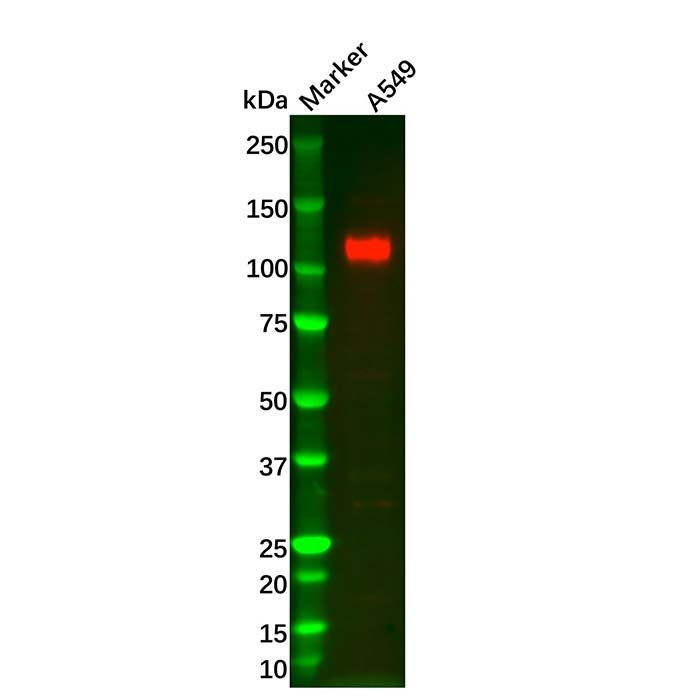 Recombinant LI Cadherin Antibody