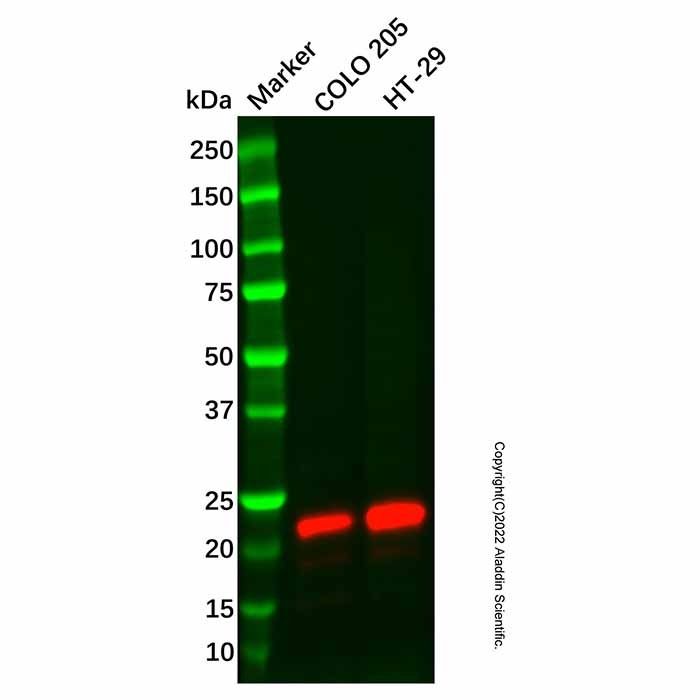 Recombinant Lipocalin-2/NGAL Antibody
