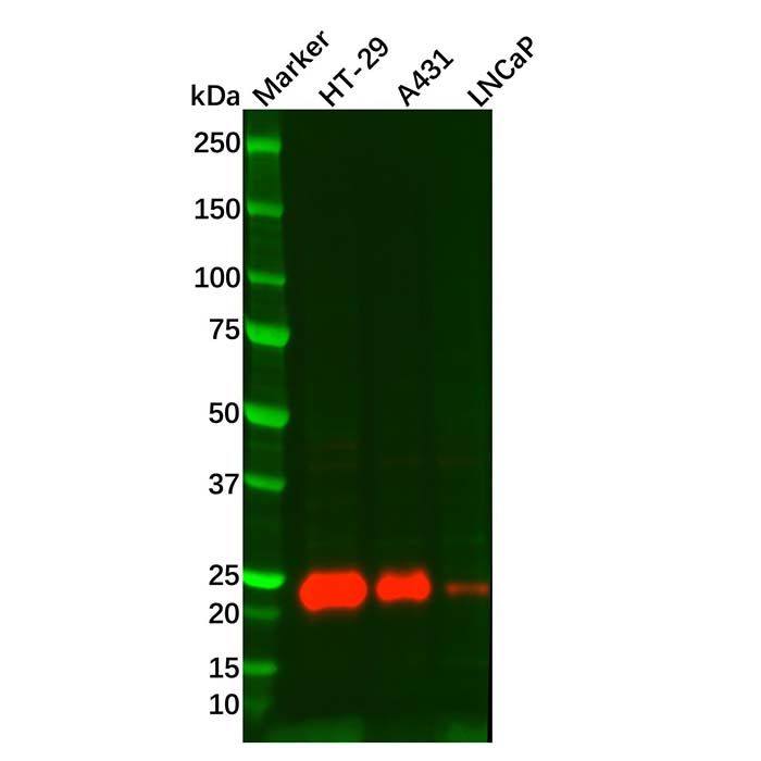 Lipocalin-2/NGAL Mouse mAb