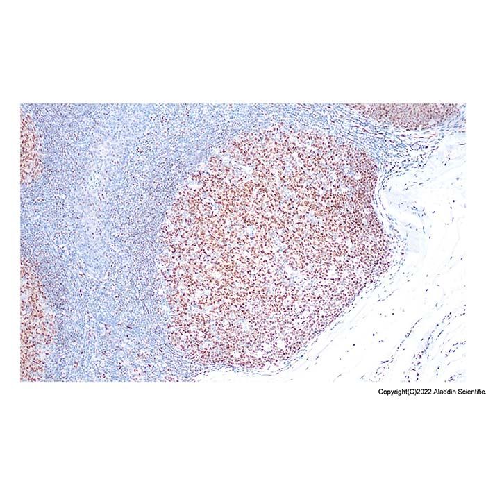 Recombinant LMO2 Antibody