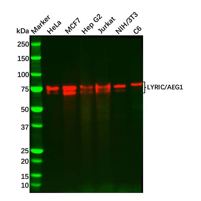 Recombinant LYRIC/AEG1 Antibody