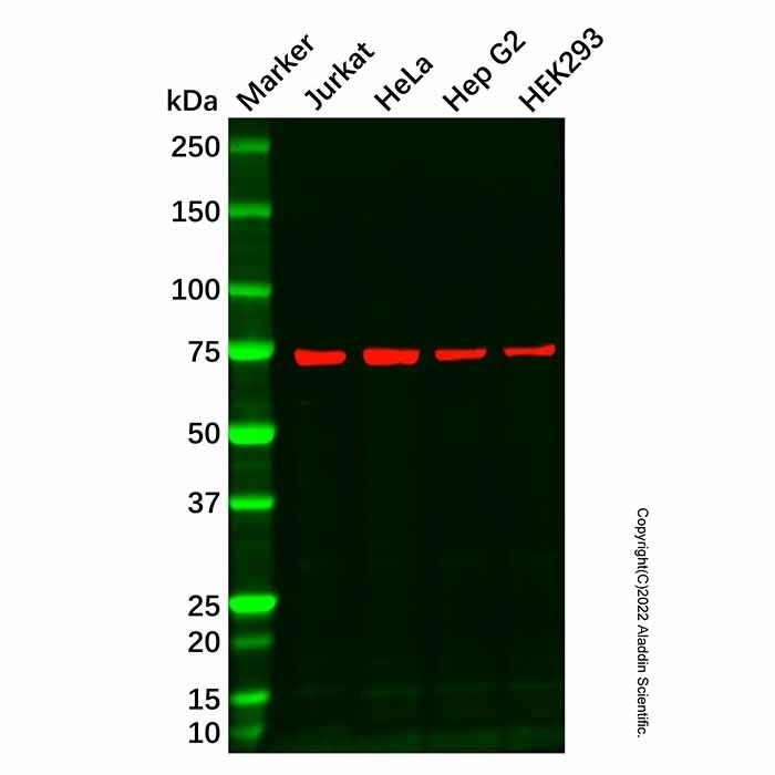 Recombinant LysRS Antibody