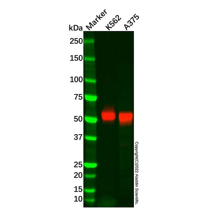 Recombinant MAGEC2 Antibody