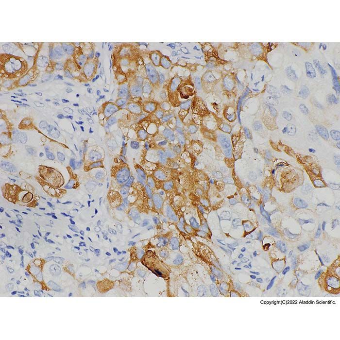 Mammaglobin A Mouse mAb