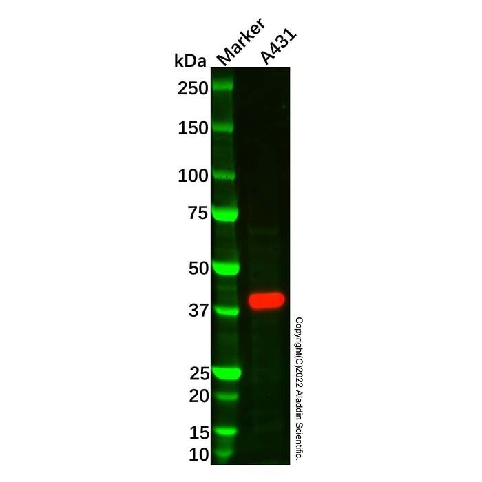 MASPIN Antibody