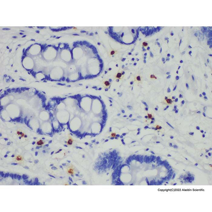 Mast Cell Tryptase Mouse mAb