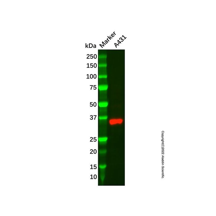 Recombinant MC1-R Antibody