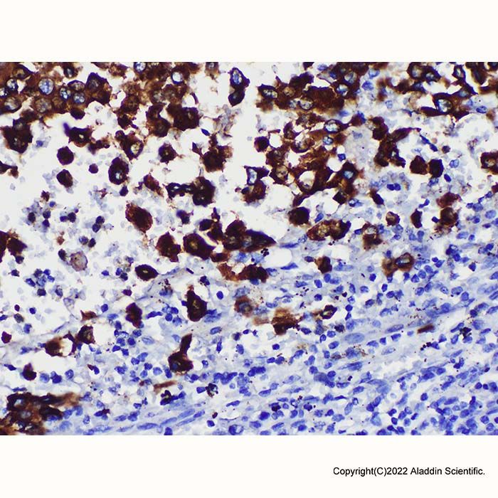 MelanA Mouse mAb