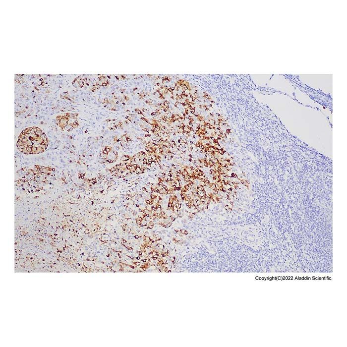 Recombinant Melanoma gp100 Antibody