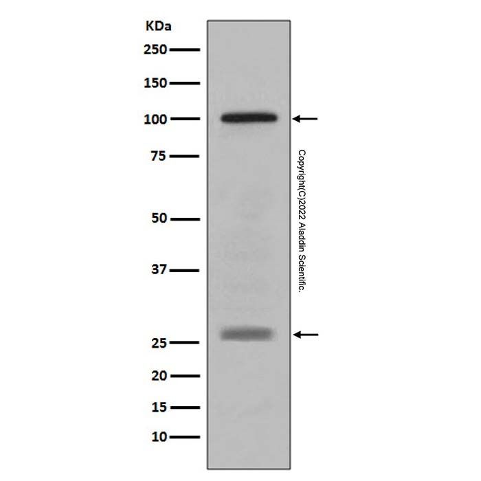 Recombinant Melanoma gp100 Antibody