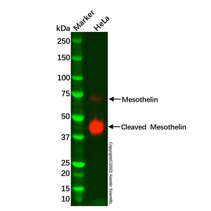 Recombinant Mesothelin Antibody