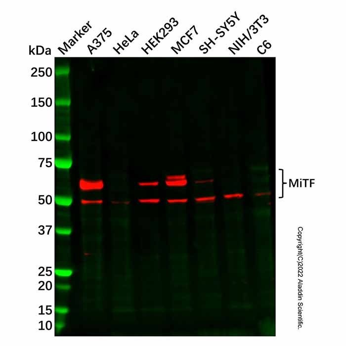 Recombinant MiTF Antibody
