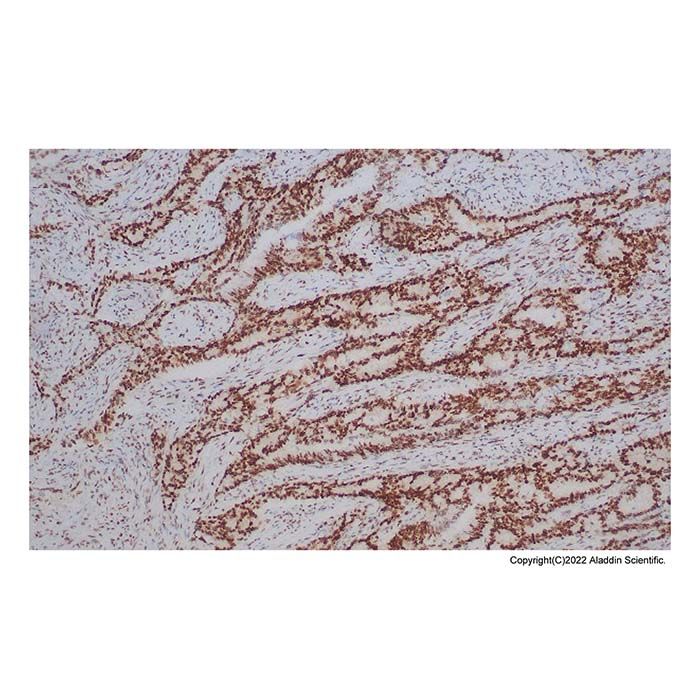 Recombinant MLH1 Antibody