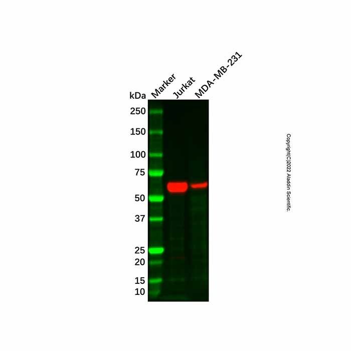 Recombinant MMP13 Antibody