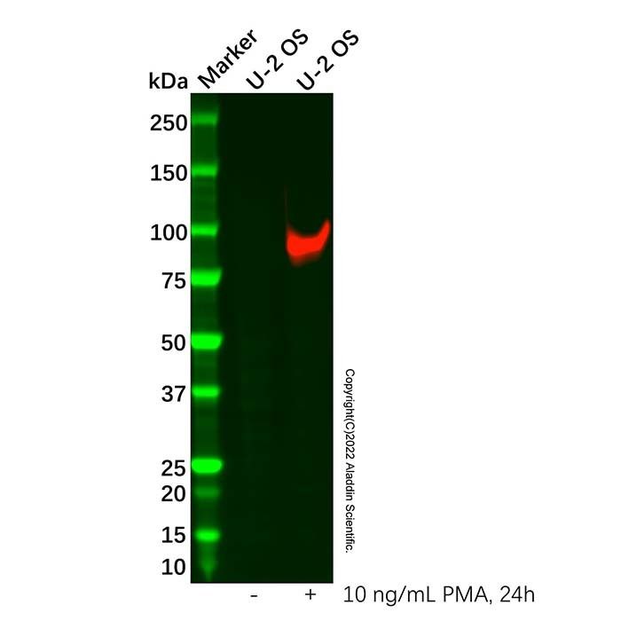 MMP9 antibody