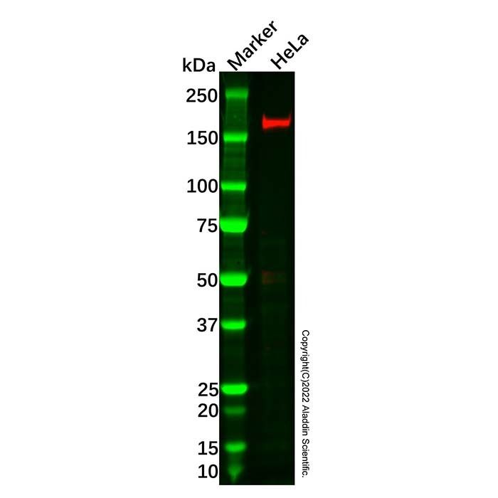 Recombinant MSH6 Antibody