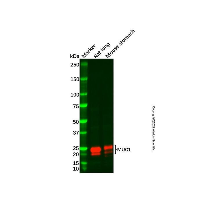 Recombinant MUC1 Antibody
