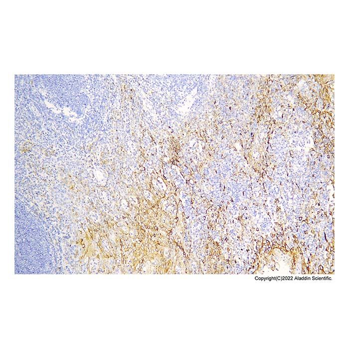 Recombinant MUC1 Antibody