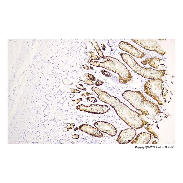 Recombinant Mucin 5AC Antibody