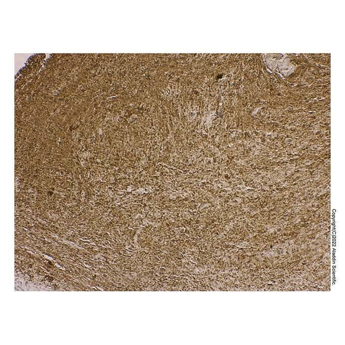 Recombinant Myelin Basic Protein Antibody