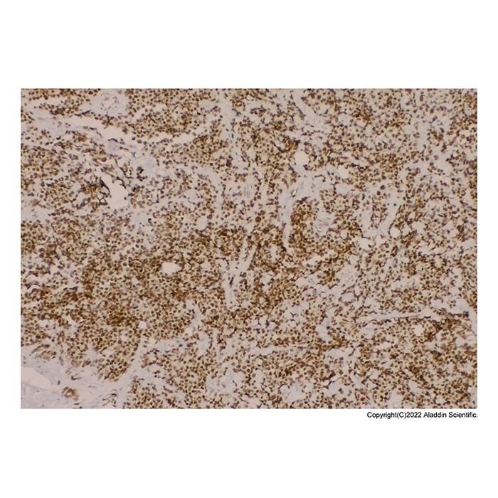 Recombinant MyoD1 Antibody