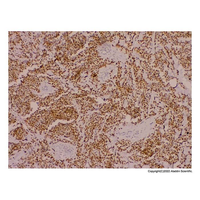 Recombinant Myogenin Antibody
