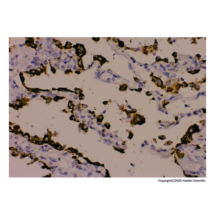 Recombinant NAPSIN A Antibody