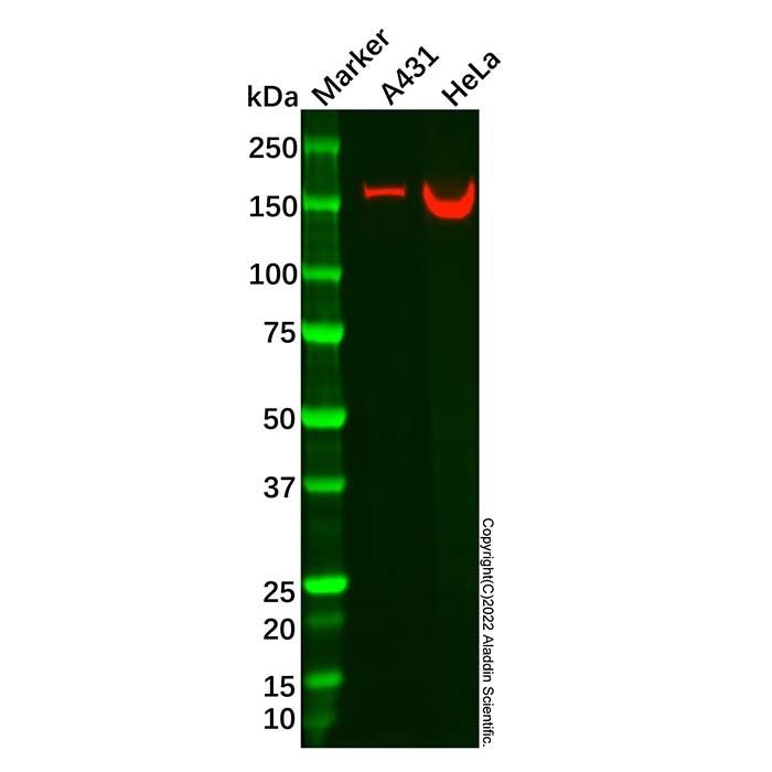 Recombinant NCAPD2 Antibody