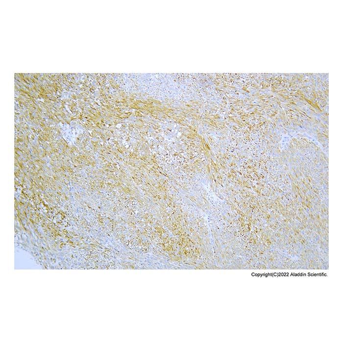 Recombinant Nestin Antibody