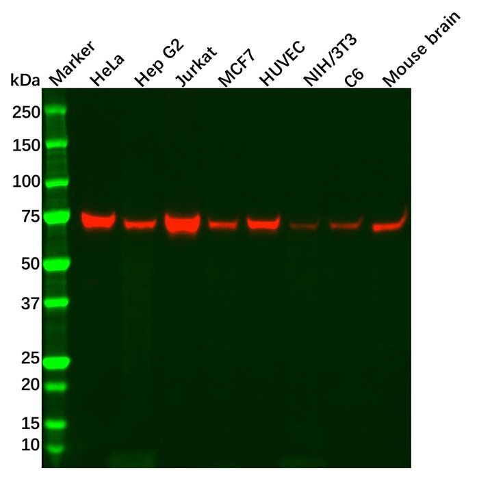 Recombinant NF2/Merlin Antibody
