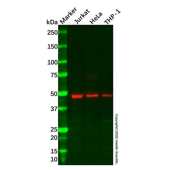 Recombinant NK-1R Antibody