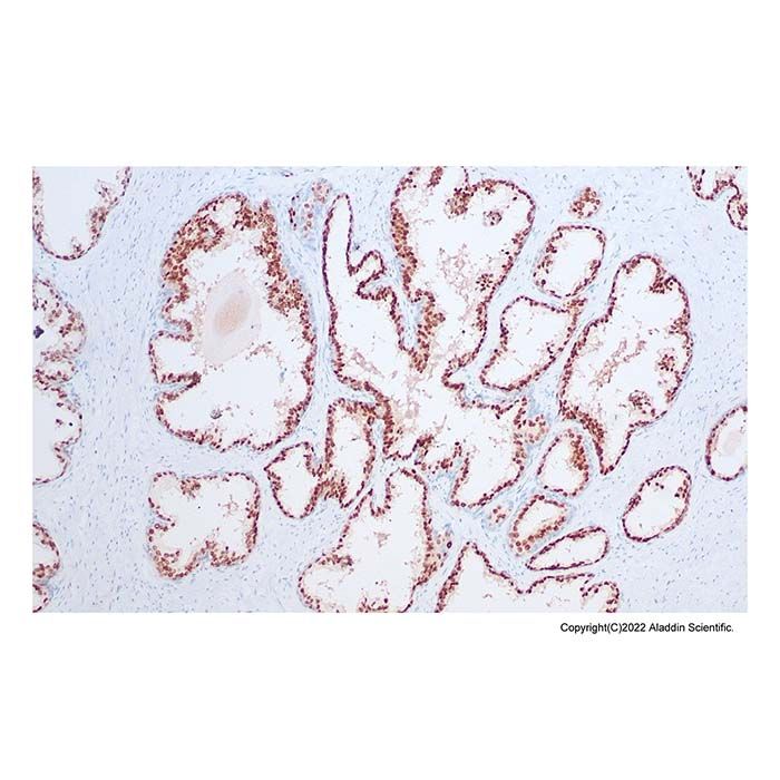 Recombinant Nkx3.1 Antibody