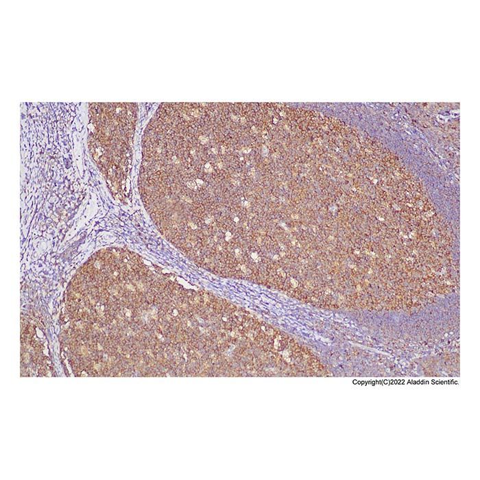 Recombinant NM23A Antibody