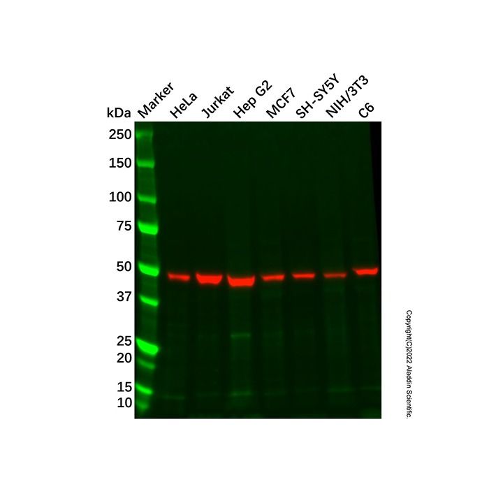Recombinant NSE Antibody