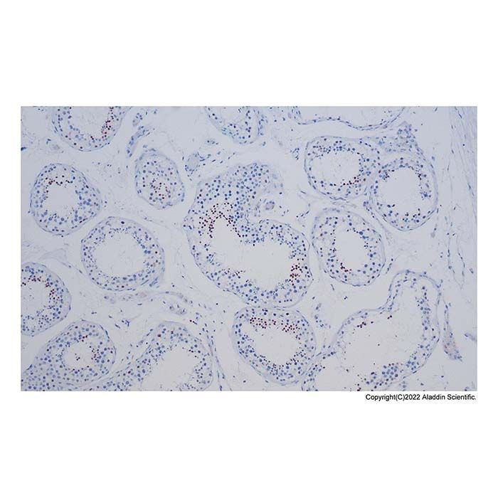 Recombinant NUT Antibody