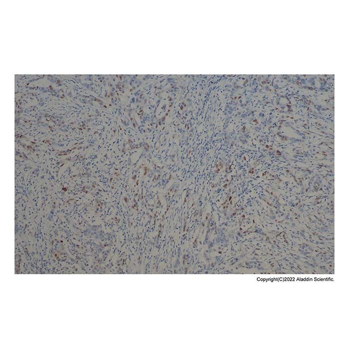Recombinant p21 Antibody