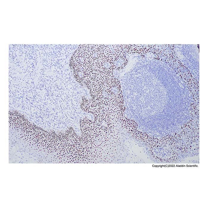 Recombinant p40 - DeltaNp63 Antibody