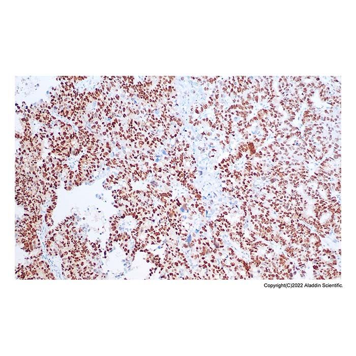 Recombinant p53 Antibody