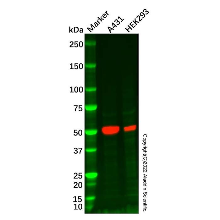 Recombinant p53 Antibody