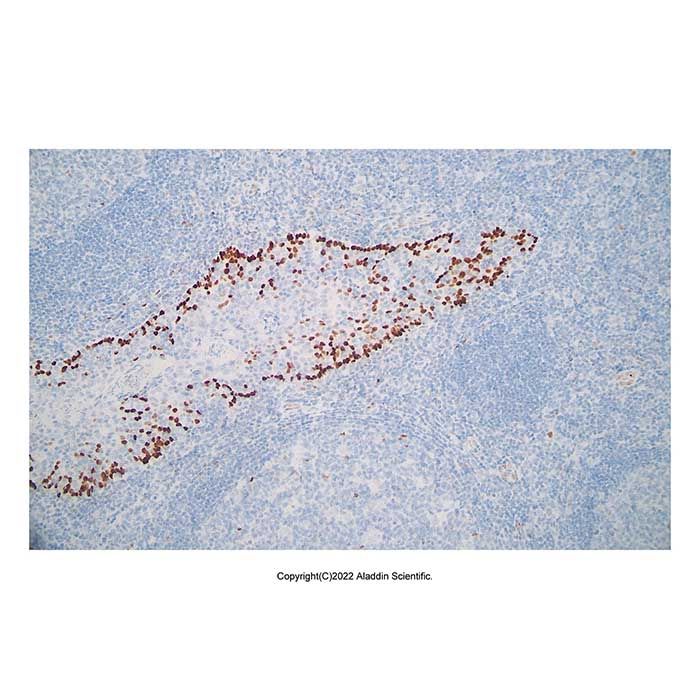 Recombinant p63 Antibody