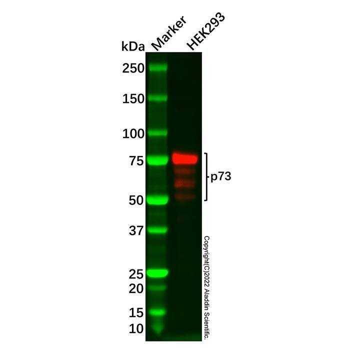 Recombinant p73 Antibody