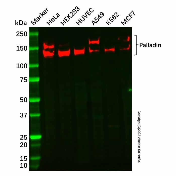 Recombinant Palladin Antibody